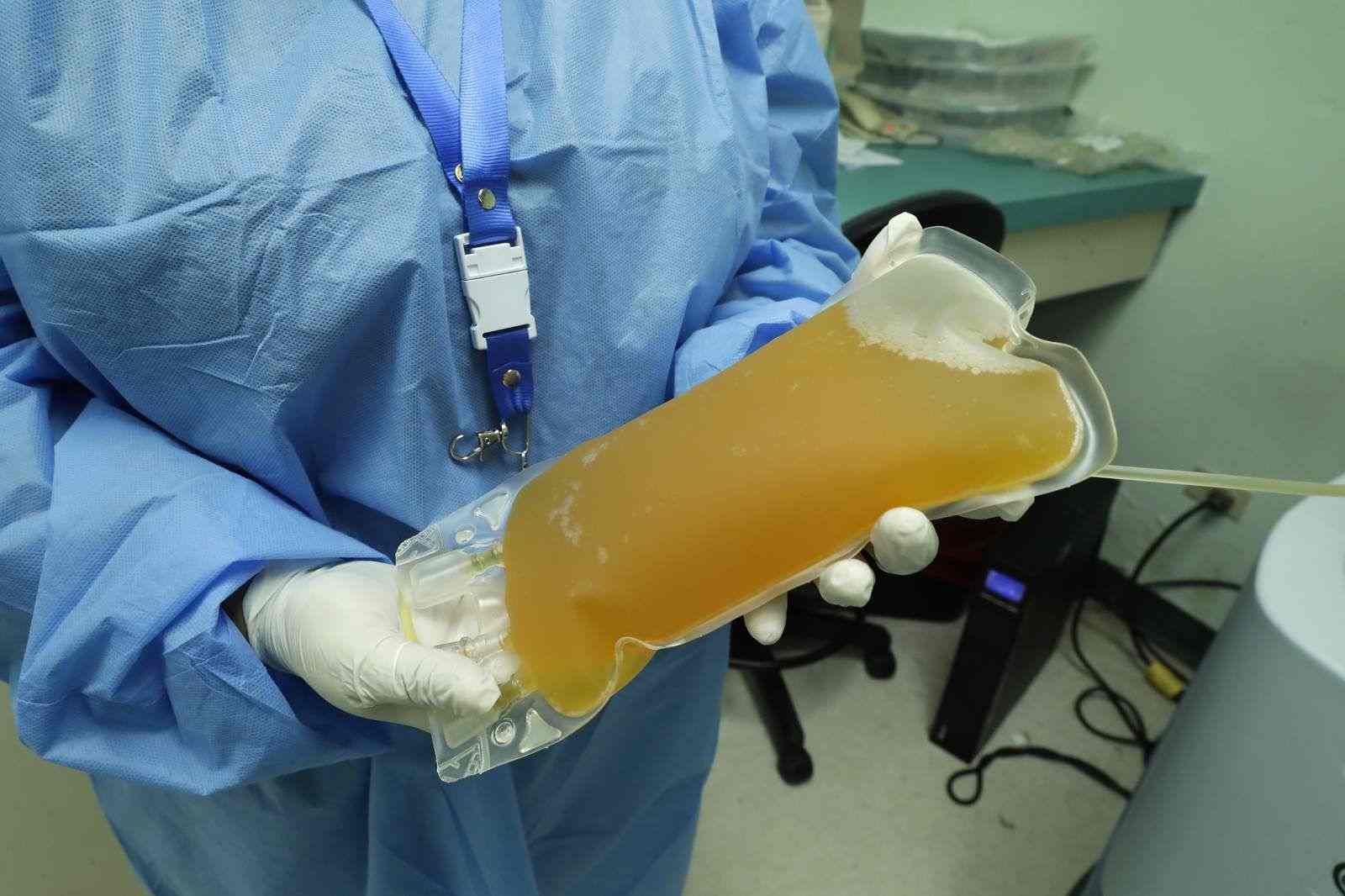 PLASMA DONATION